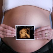 Όλοι οι απαραίτητοι υπέρηχοι στη διάρκεια της εγκυμοσύνη